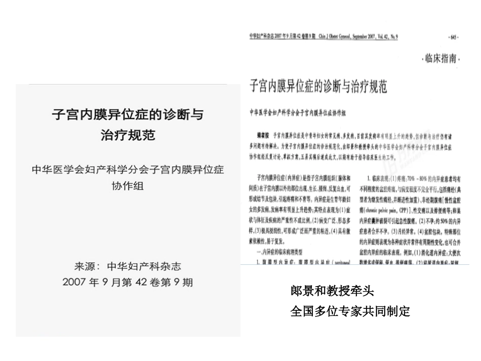 子宫内膜异位症诊治指南培训课件.pptx_第2页