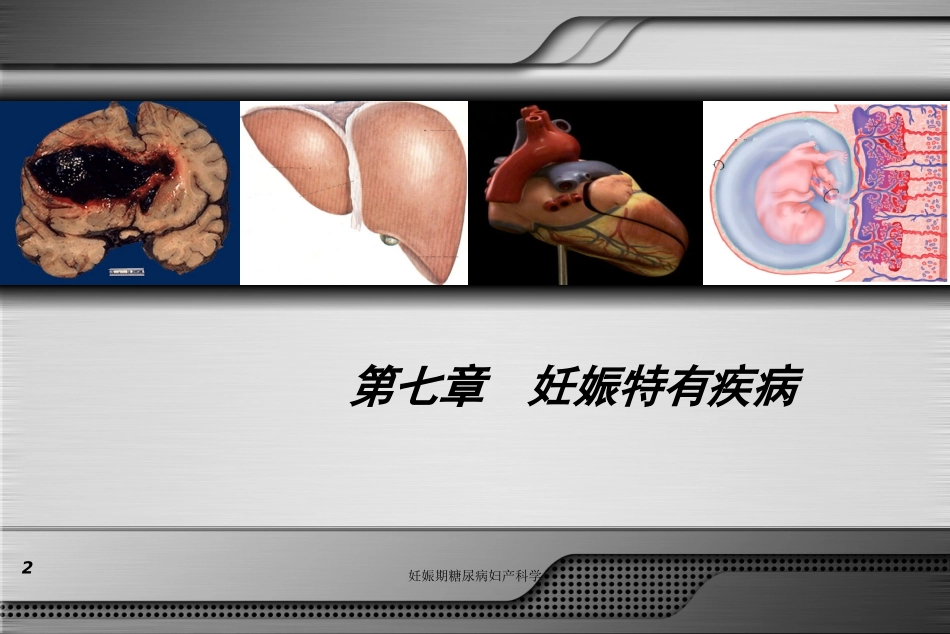 妊娠期糖尿病妇产科学培训课件.pptx_第2页
