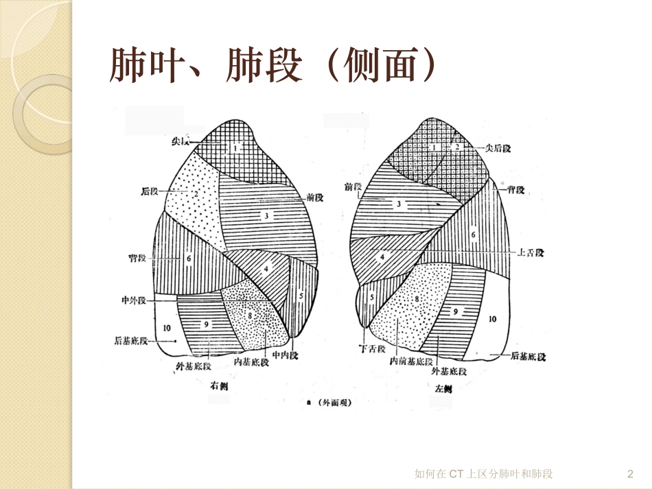 如何在CT上区分肺叶和肺段培训课件.pptx_第2页