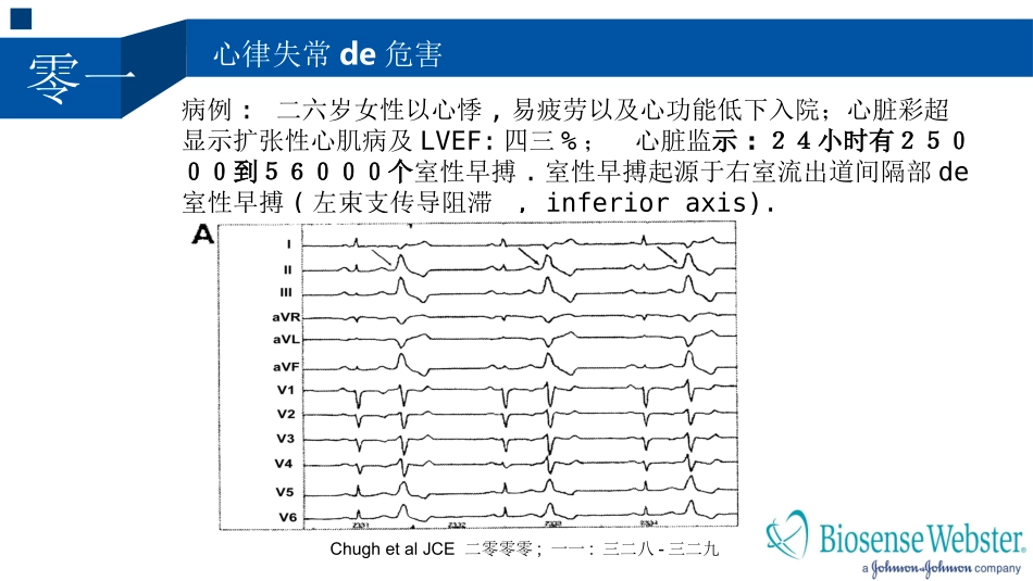 室性心律失常的射频消融治疗培训课件.pptx_第3页