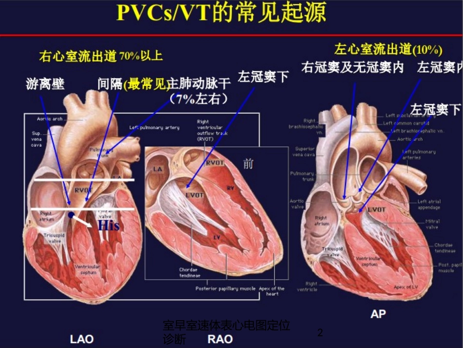 室早室速体表心电图定位诊断培训课件.pptx_第2页