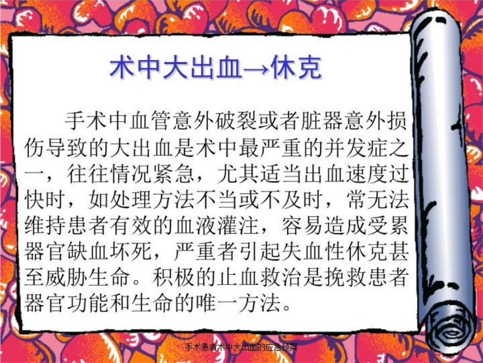 手术患者术中大出血的应急预案培训课件.pptx_第2页