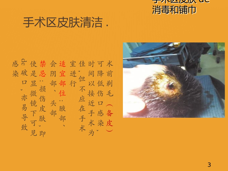 手术区皮肤的消毒和铺巾培训课件.pptx_第3页