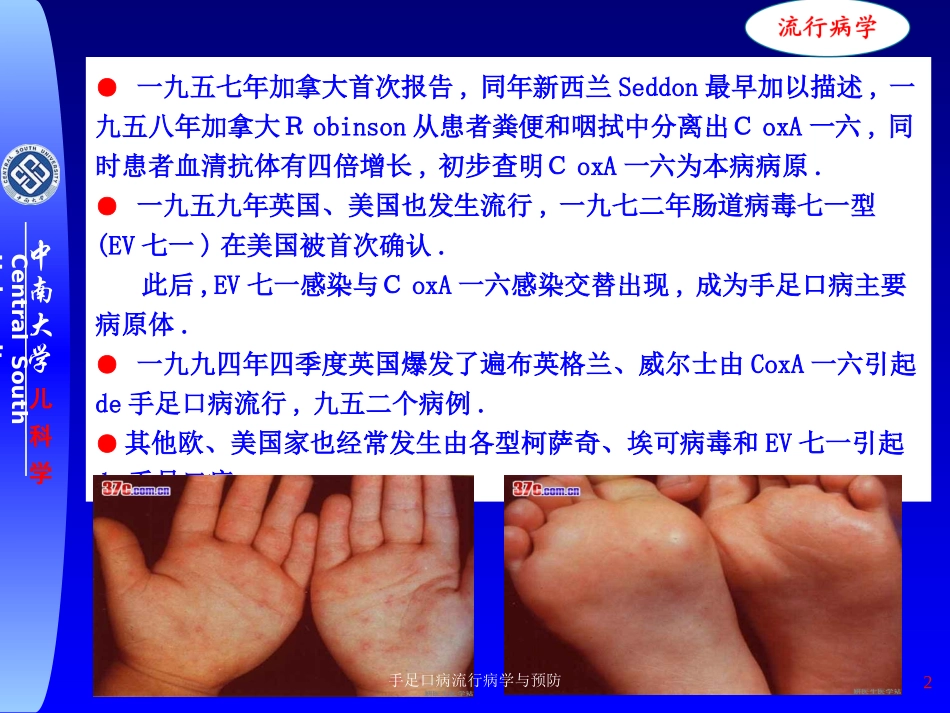 手足口病流行病学与预防培训课件.pptx_第2页