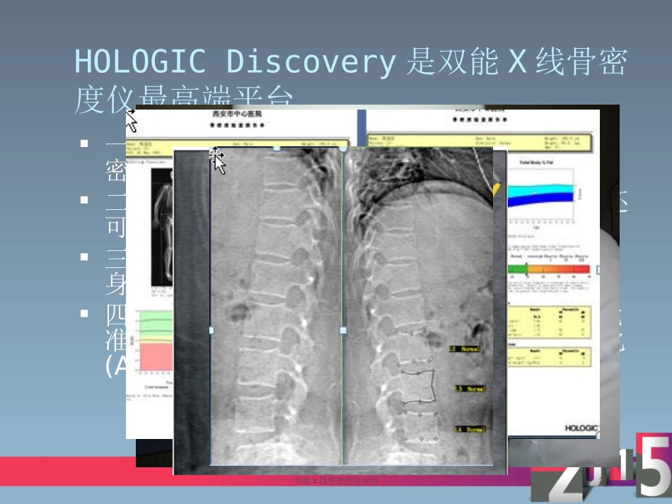 双能x线骨密度仪应用培训课件.pptx_第2页