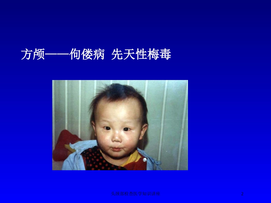 头颈部检查医学知识讲座培训课件.pptx_第2页