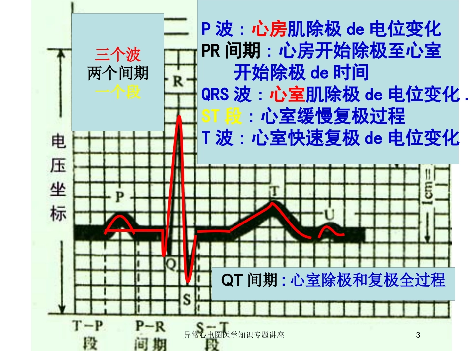 异常心电图医学知识专题讲座培训课件.pptx_第3页