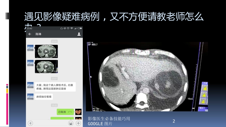 影像医生必备技能巧用GOOGLE图片培训课件.pptx_第2页