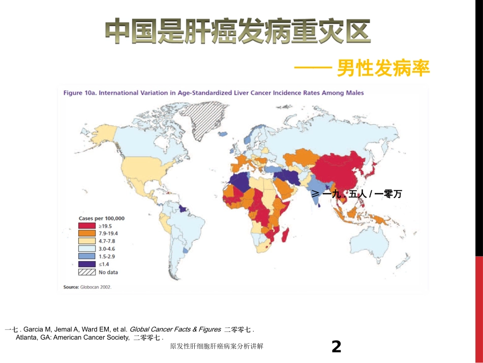 原发性肝细胞肝癌病案分析讲解培训课件.pptx_第2页