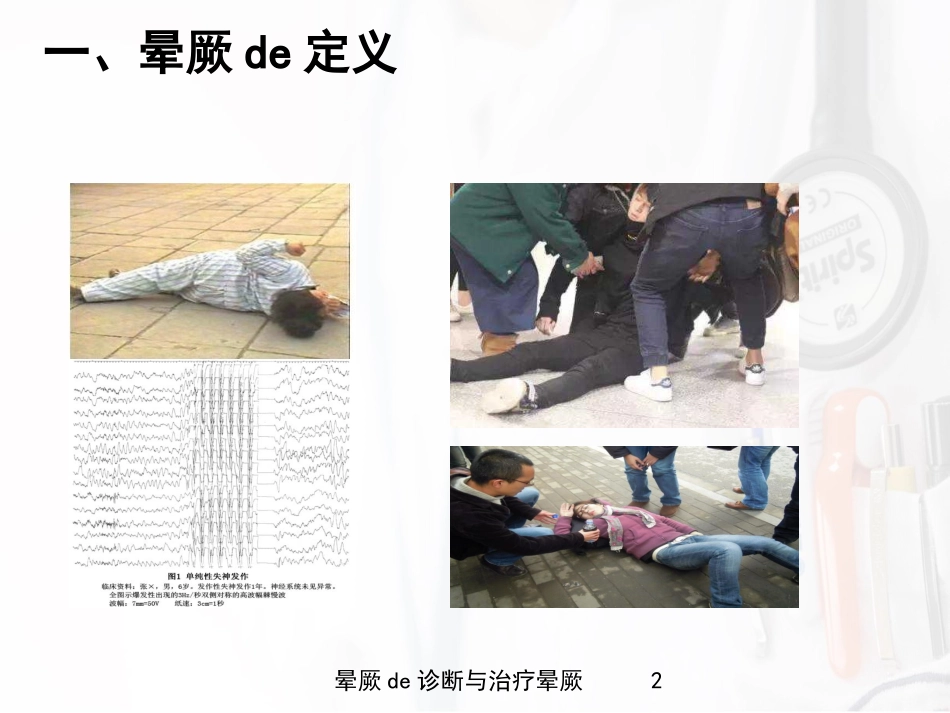 晕厥的诊断与治疗晕厥培训课件.pptx_第2页