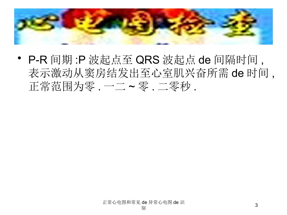正常心电图和常见的异常心电图的识别培训课件.pptx_第3页