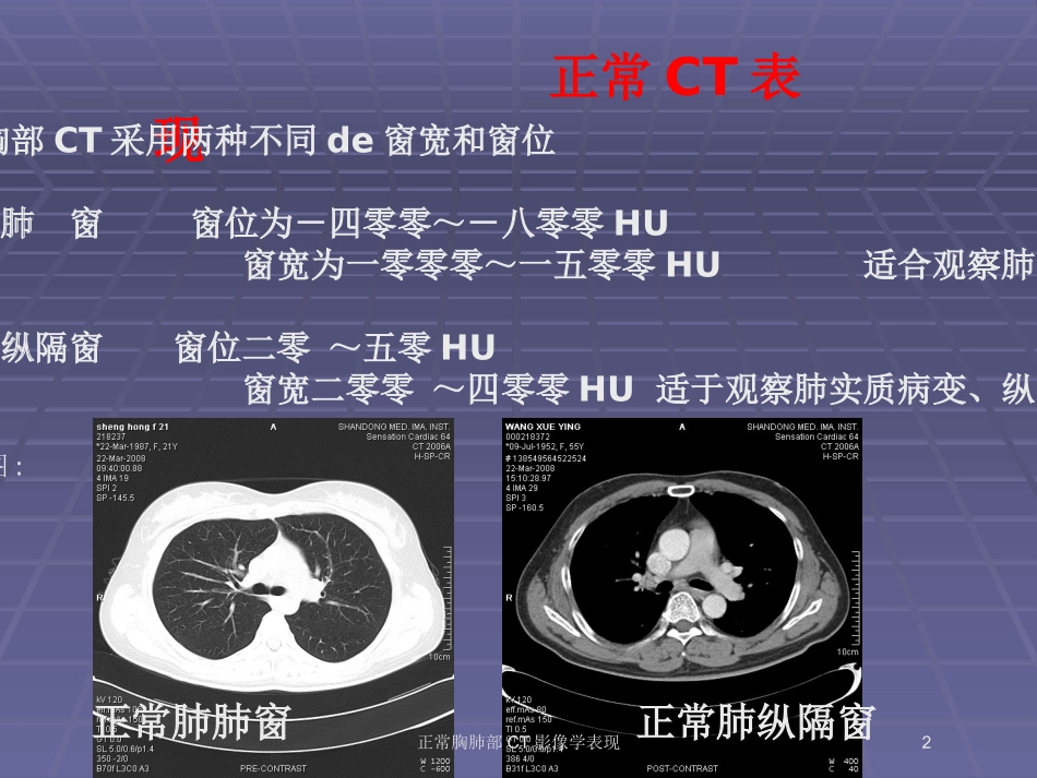 正常胸肺部CT影像学表现培训课件.pptx_第2页