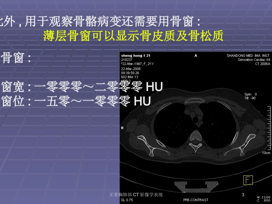 正常胸肺部CT影像学表现培训课件.pptx_第3页