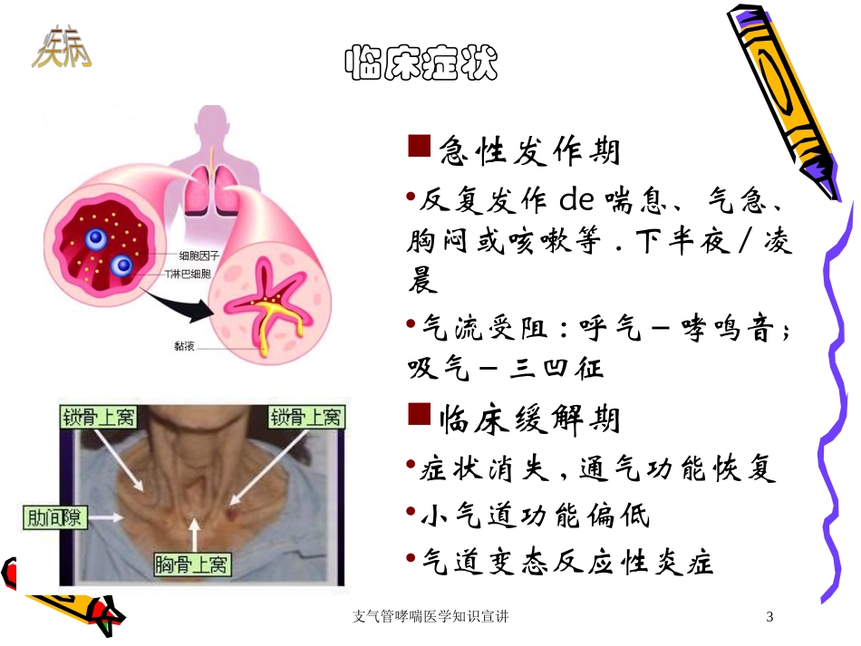 支气管哮喘医学知识宣讲培训课件.pptx_第3页