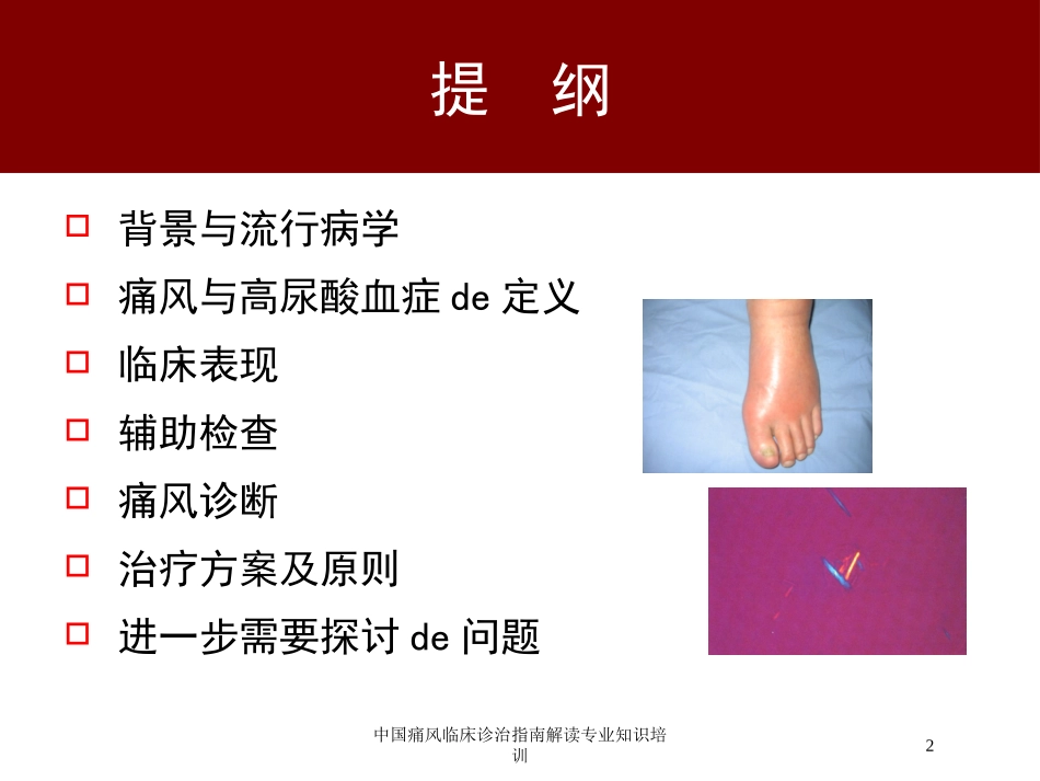 中国痛风临床诊治指南解读专业知识培训培训课件.pptx_第2页