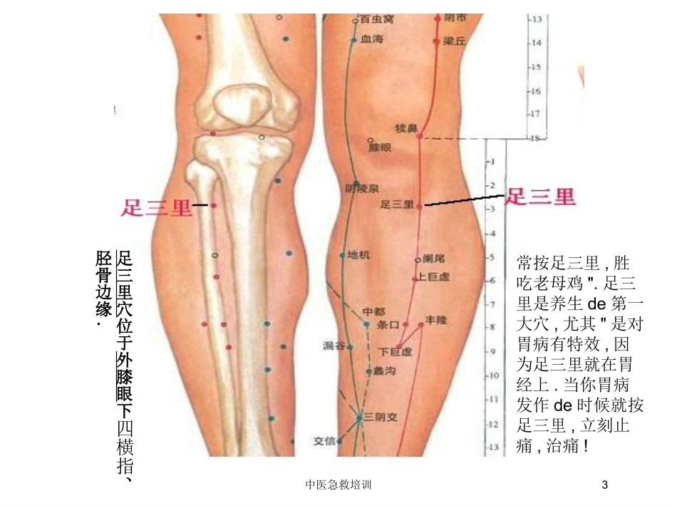中医急救培训培训课件.pptx_第3页