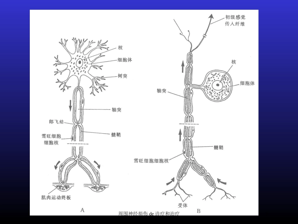 周围神经损伤的诊疗和治疗培训课件.pptx_第3页