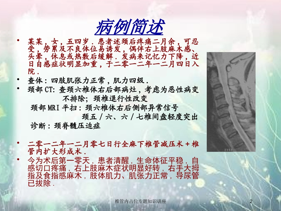椎管内占位专题知识讲座培训课件.pptx_第2页