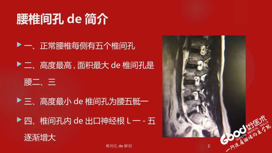 椎间孔的解剖培训课件.pptx_第2页