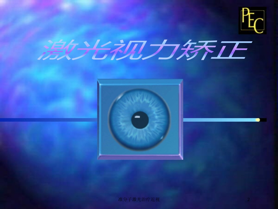 准分子激光治疗近视培训课件.pptx_第2页