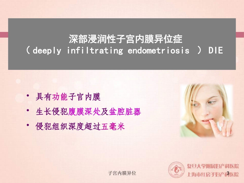 子宫内膜异位培训课件.pptx_第3页
