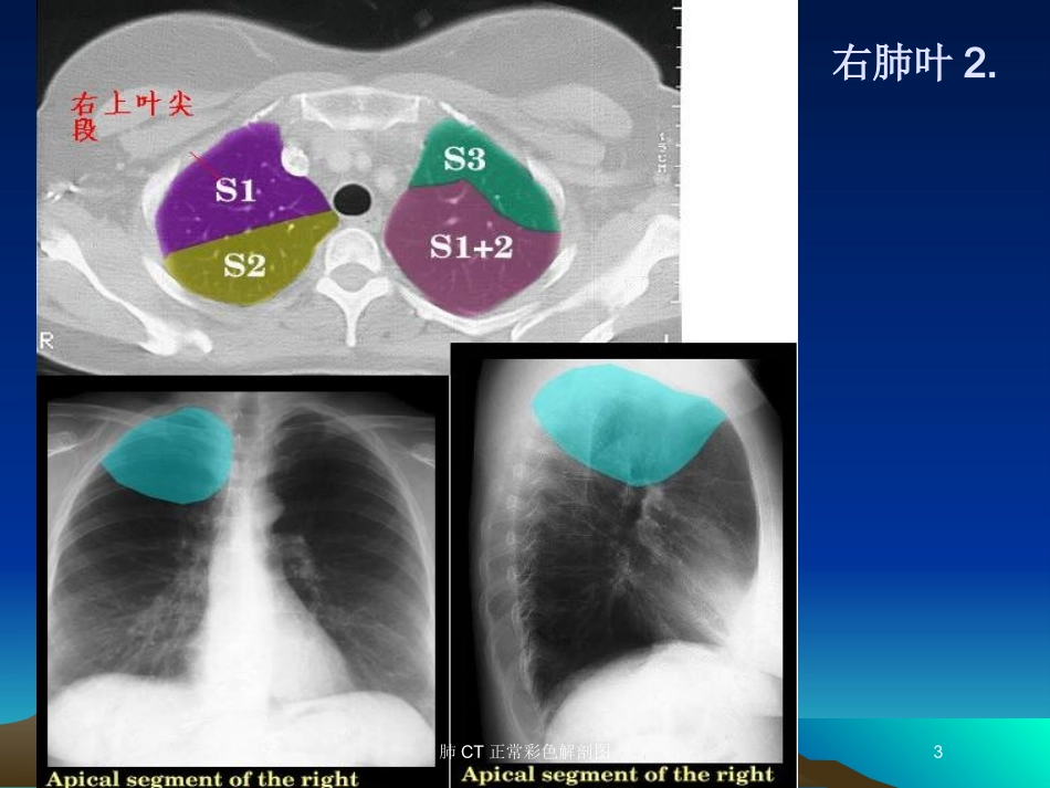 肺CT正常彩色解剖图培训课件.pptx_第3页