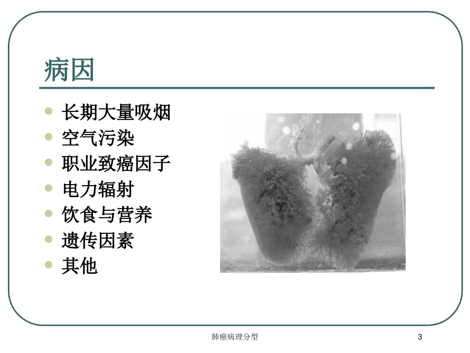 肺癌病理分型培训课件.pptx_第3页