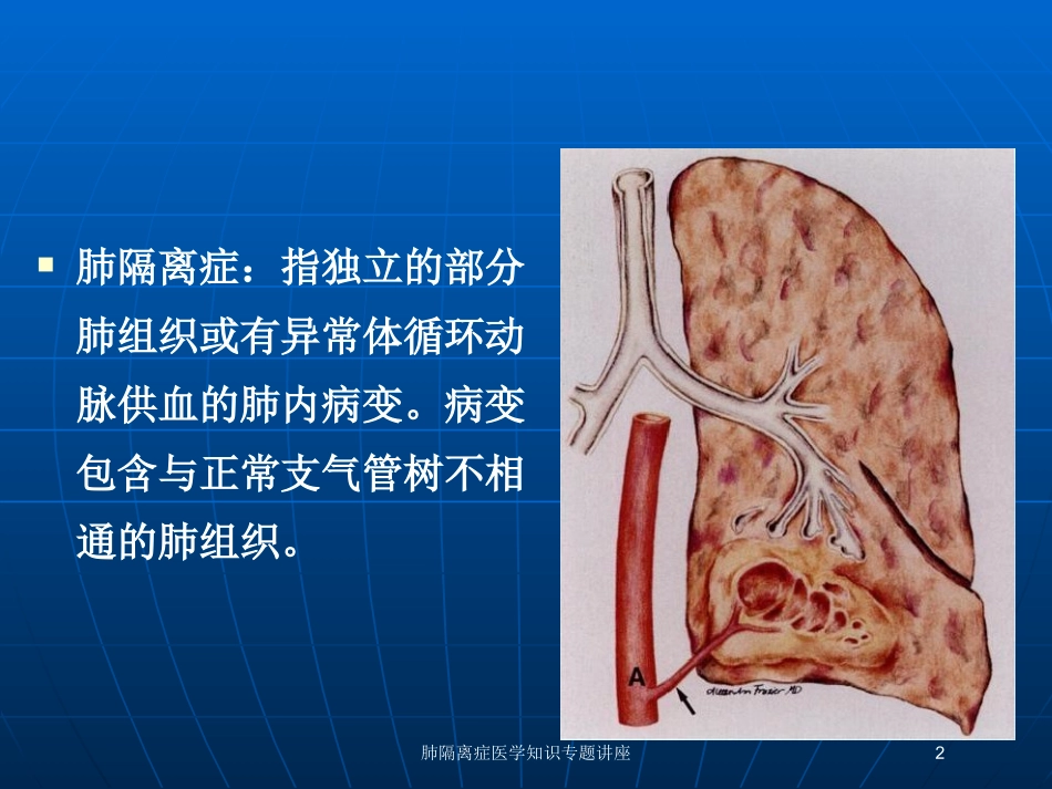 肺隔离症医学知识专题讲座培训课件.pptx_第2页