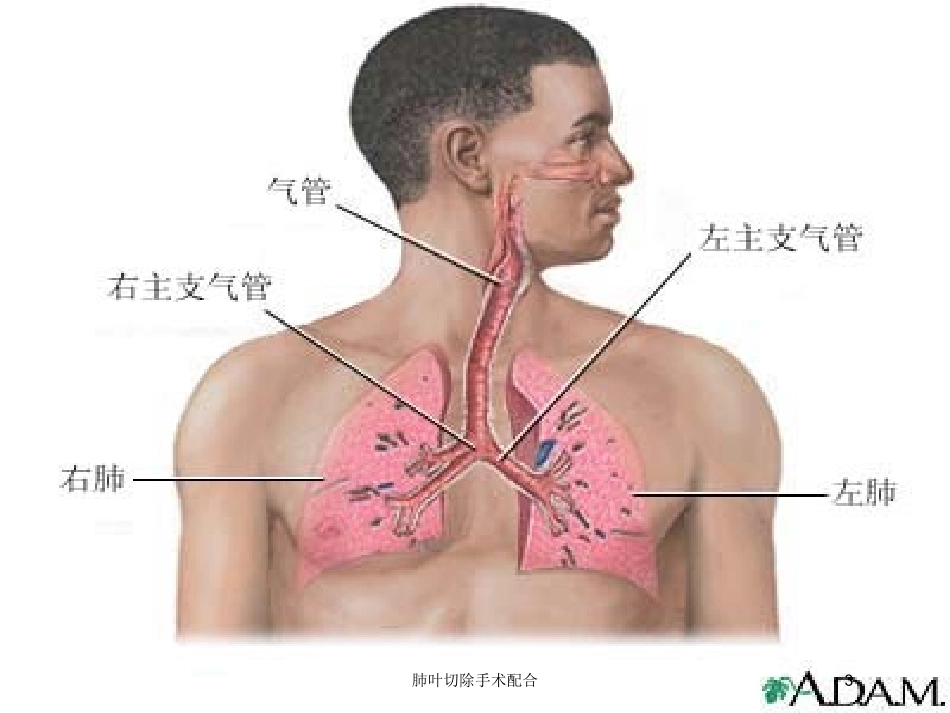 肺叶切除手术配合培训课件.pptx_第3页