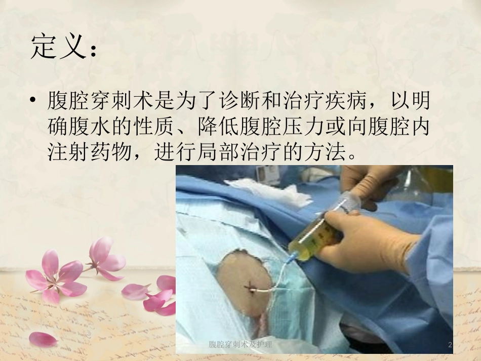 腹腔穿刺术及护理培训课件.pptx_第2页