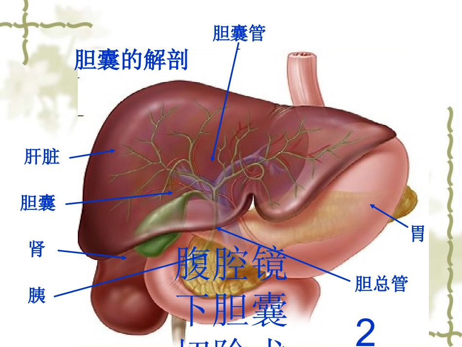 腹腔镜下胆囊切除术护理培训课件.pptx_第2页