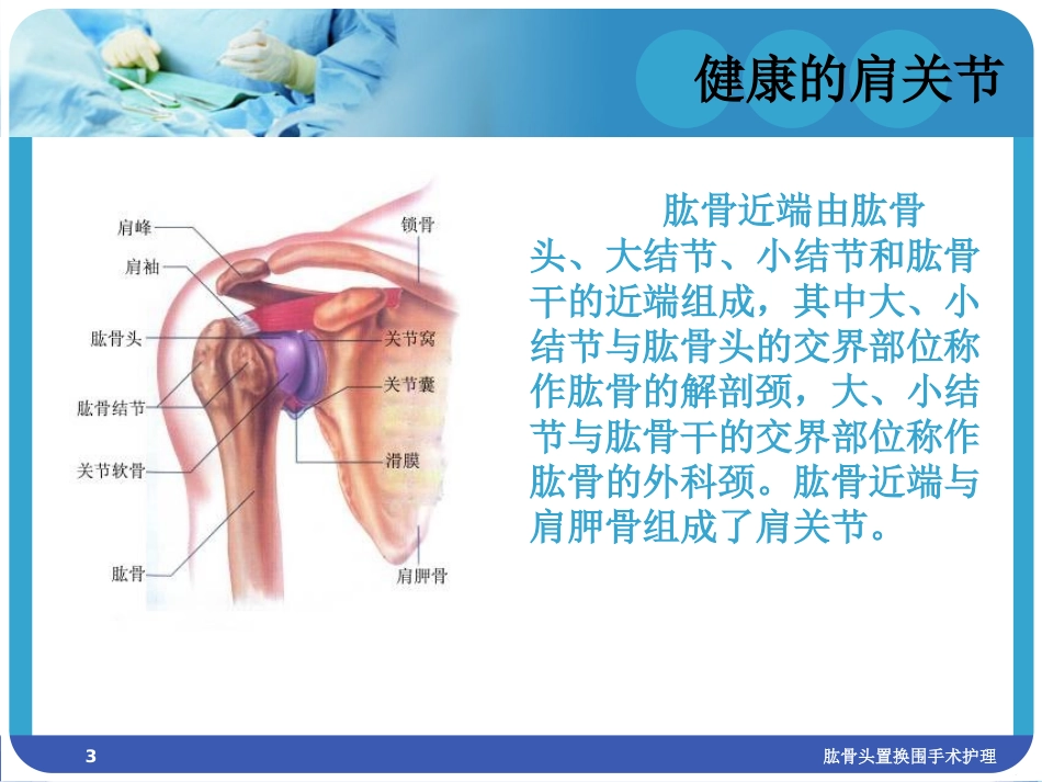 肱骨头置换围手术护理培训课件.pptx_第3页