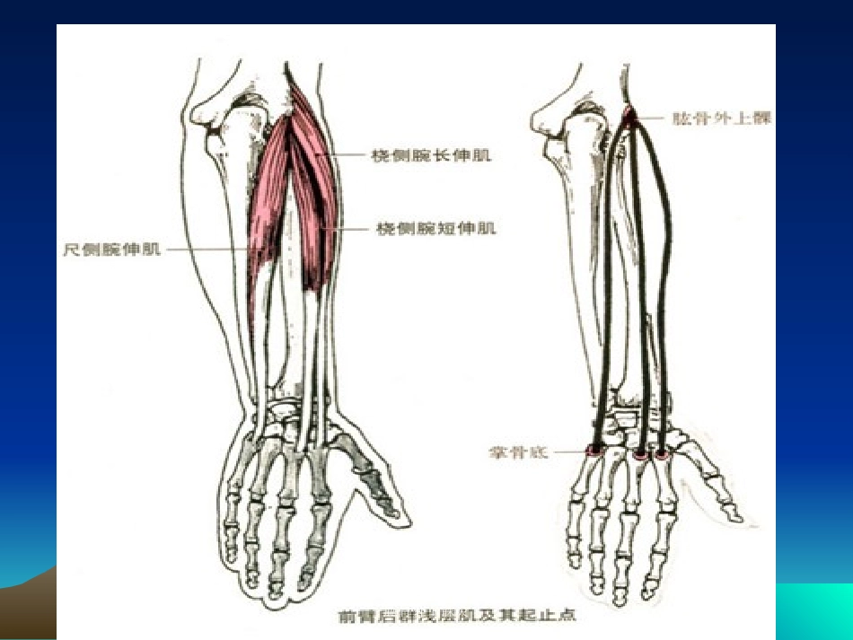 肱骨外上髁炎培训课件.pptx_第3页
