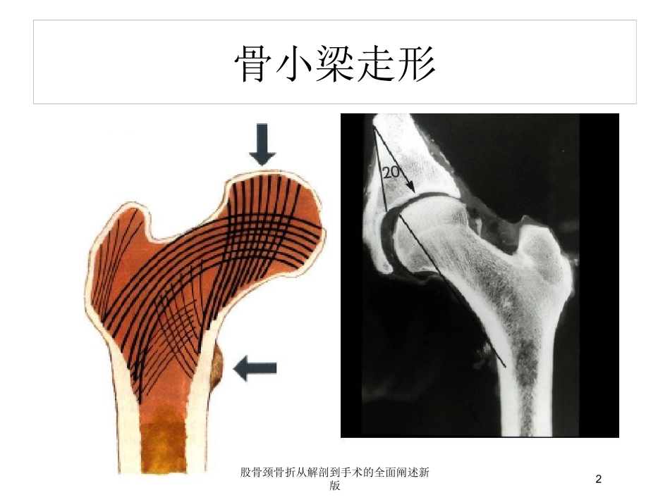 股骨颈骨折从解剖到手术的全面阐述新版培训课件.pptx_第2页