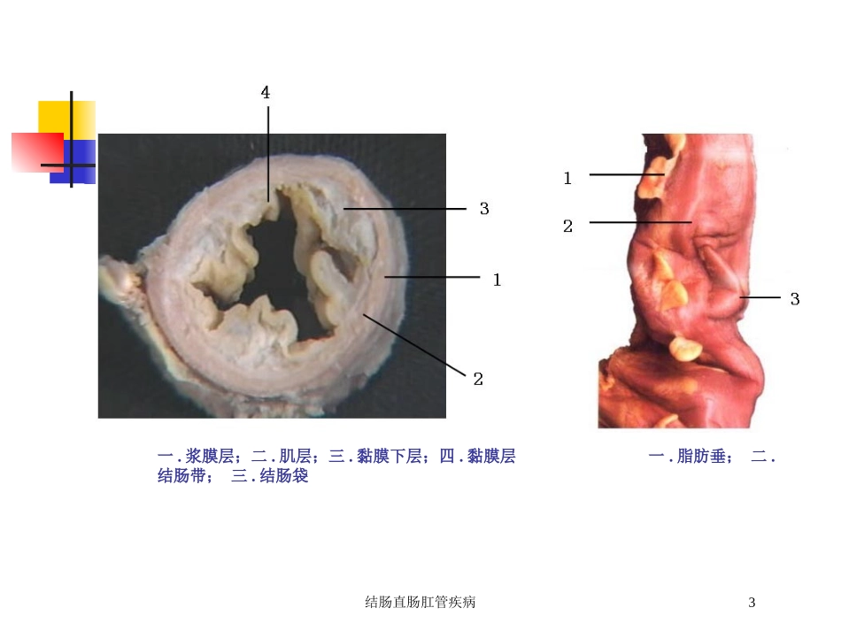 结肠直肠肛管疾病培训课件.pptx_第3页