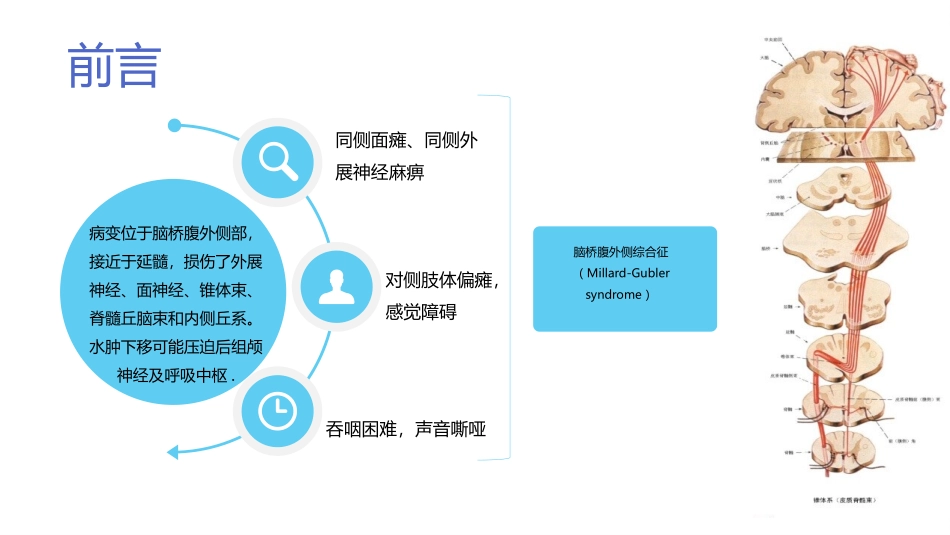 脑出血护理个案分析模板.pptx_第2页