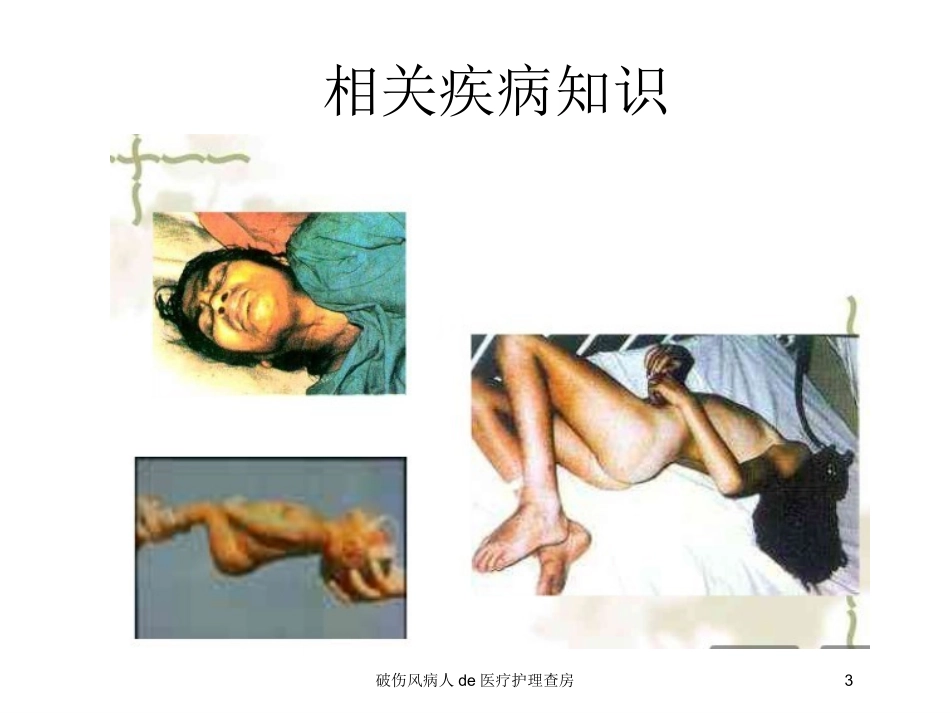 破伤风病人的医疗护理查房培训课件.pptx_第3页