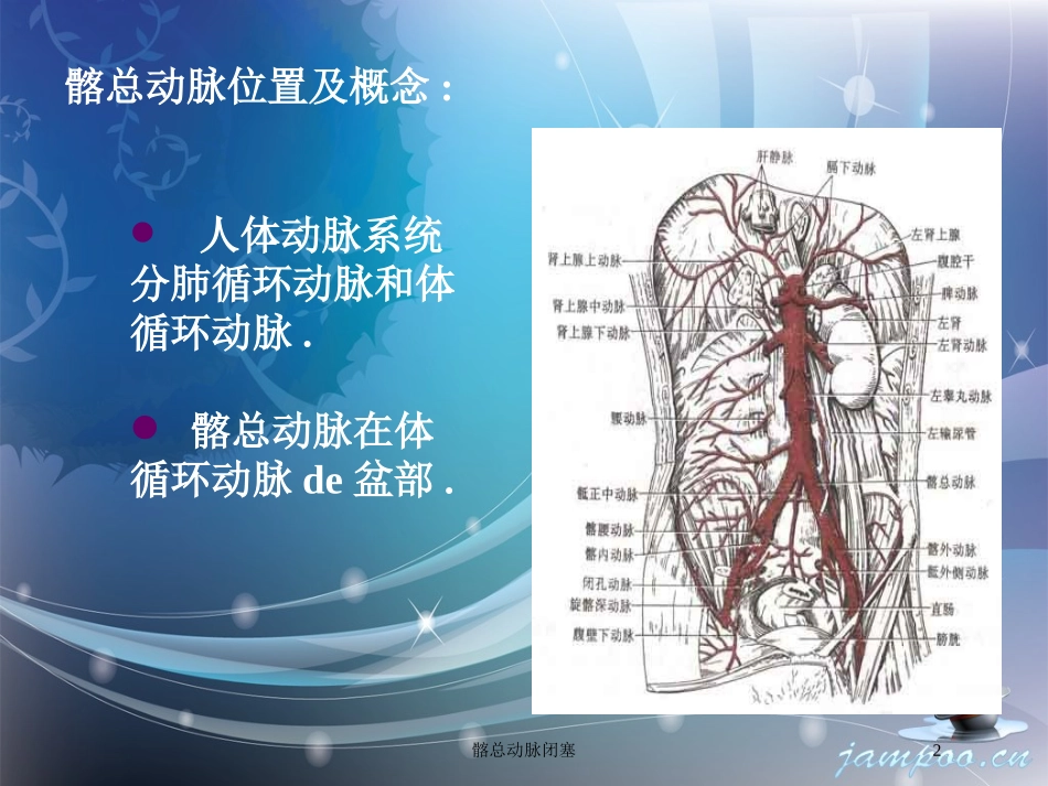 髂总动脉闭塞培训课件.pptx_第2页