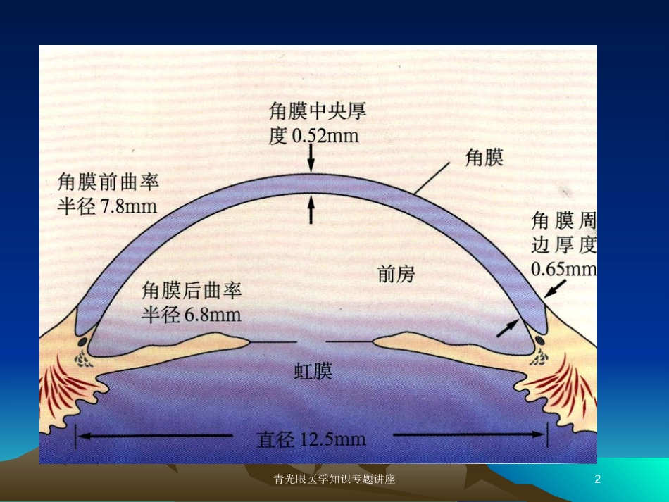 青光眼医学知识专题讲座培训课件.pptx_第2页