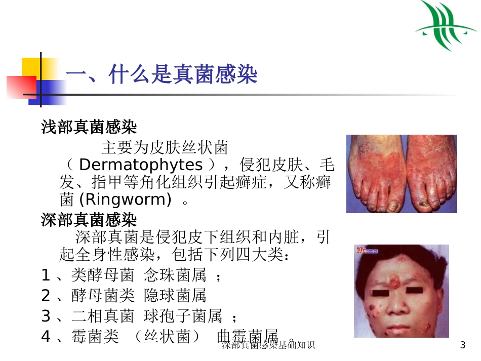 深部真菌感染基础知识培训课件.pptx_第3页