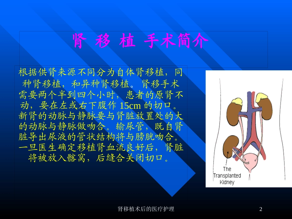 肾移植术后的医疗护理培训课件.pptx_第2页