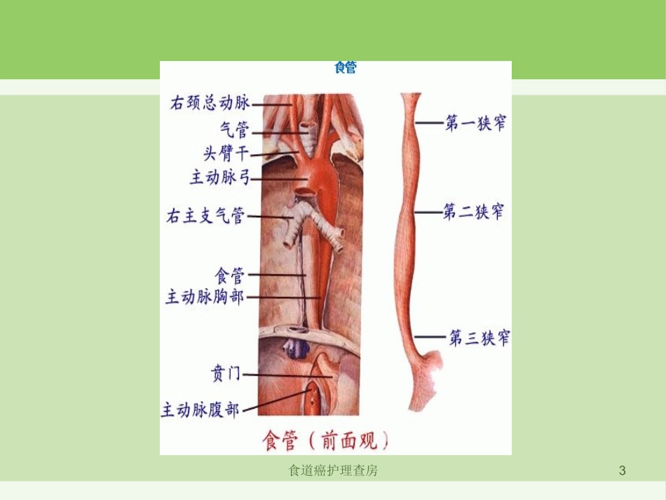 食道癌护理查房培训课件.pptx_第3页