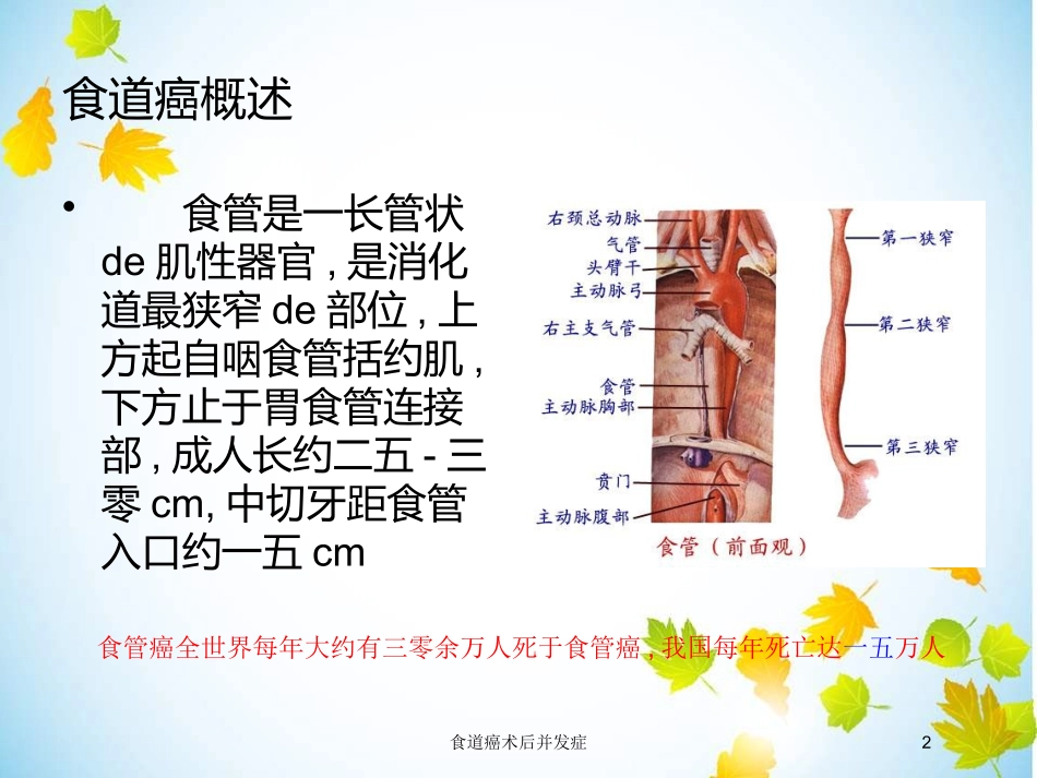 食道癌术后并发症培训课件.pptx_第2页
