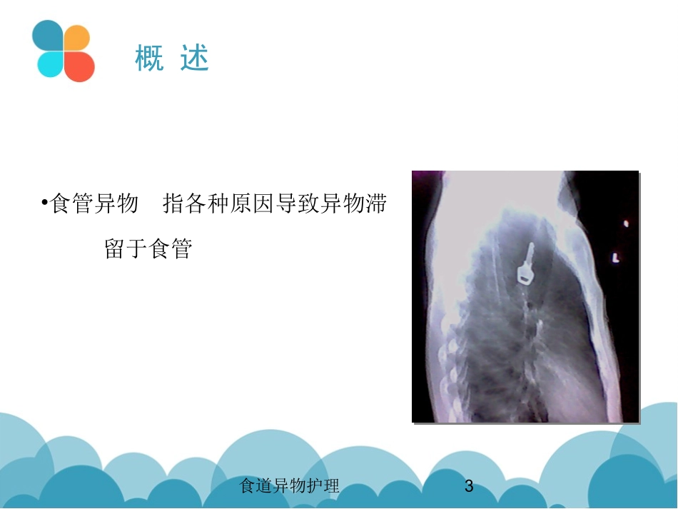 食道异物护理培训课件.pptx_第3页