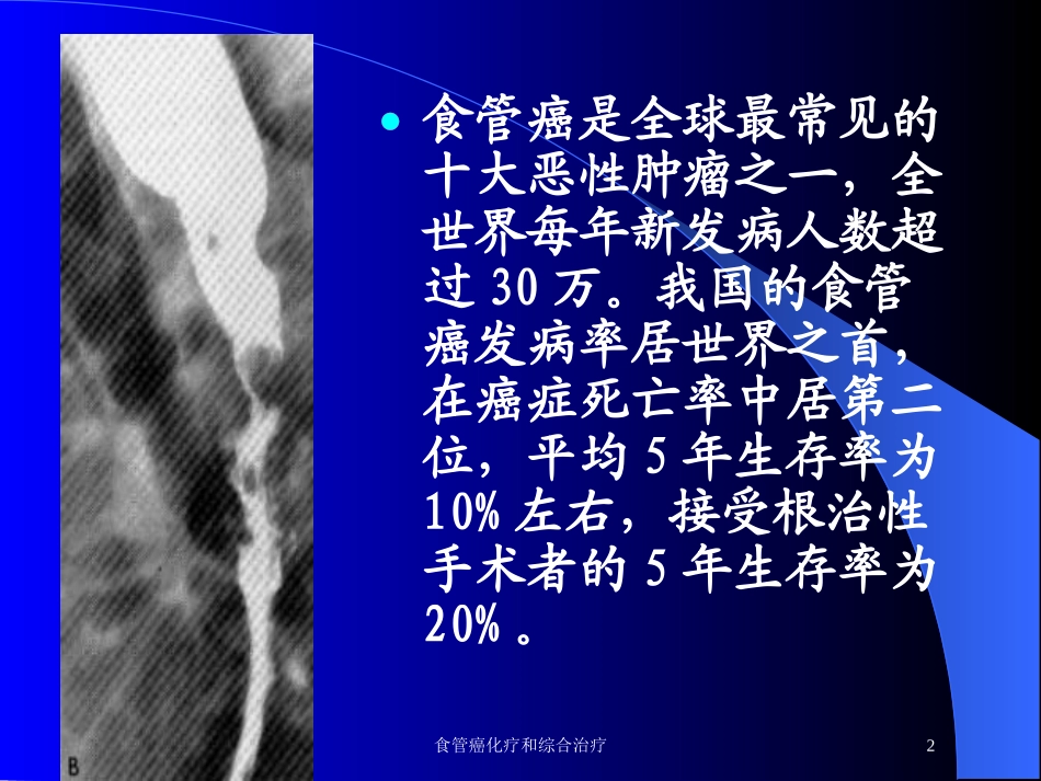 食管癌化疗和综合治疗培训课件.pptx_第2页