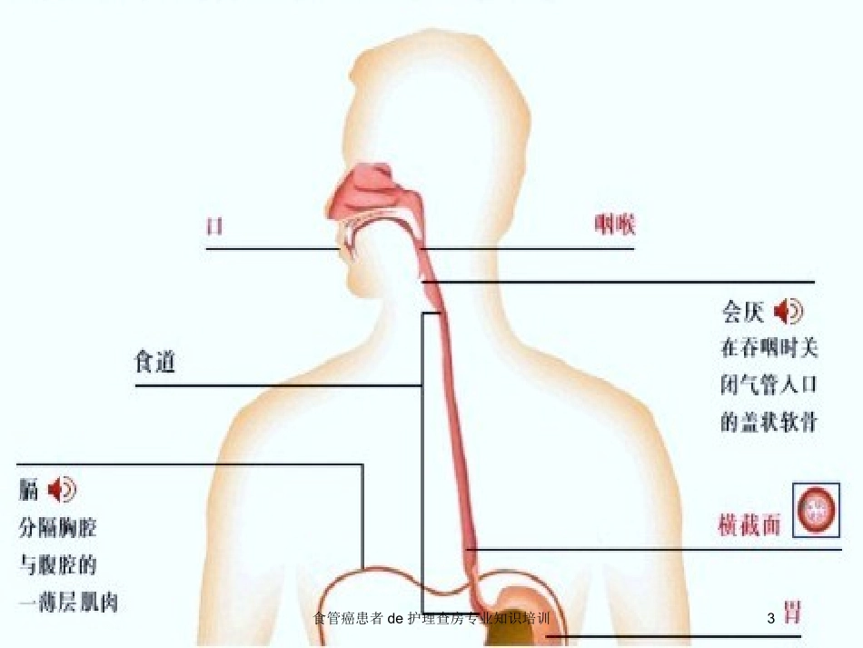 食管癌患者的护理查房专业知识培训培训课件.pptx_第3页