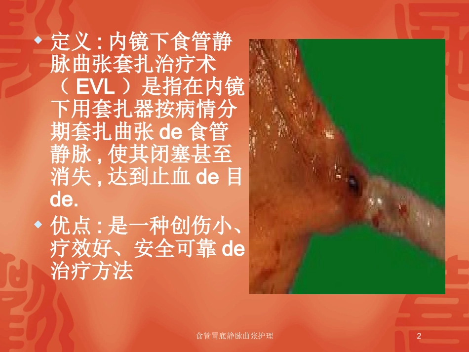 食管胃底静脉曲张护理培训课件.pptx_第2页