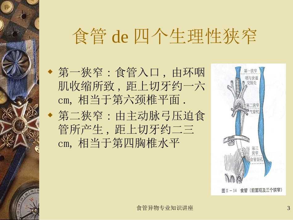 食管异物专业知识讲座培训课件.pptx_第3页