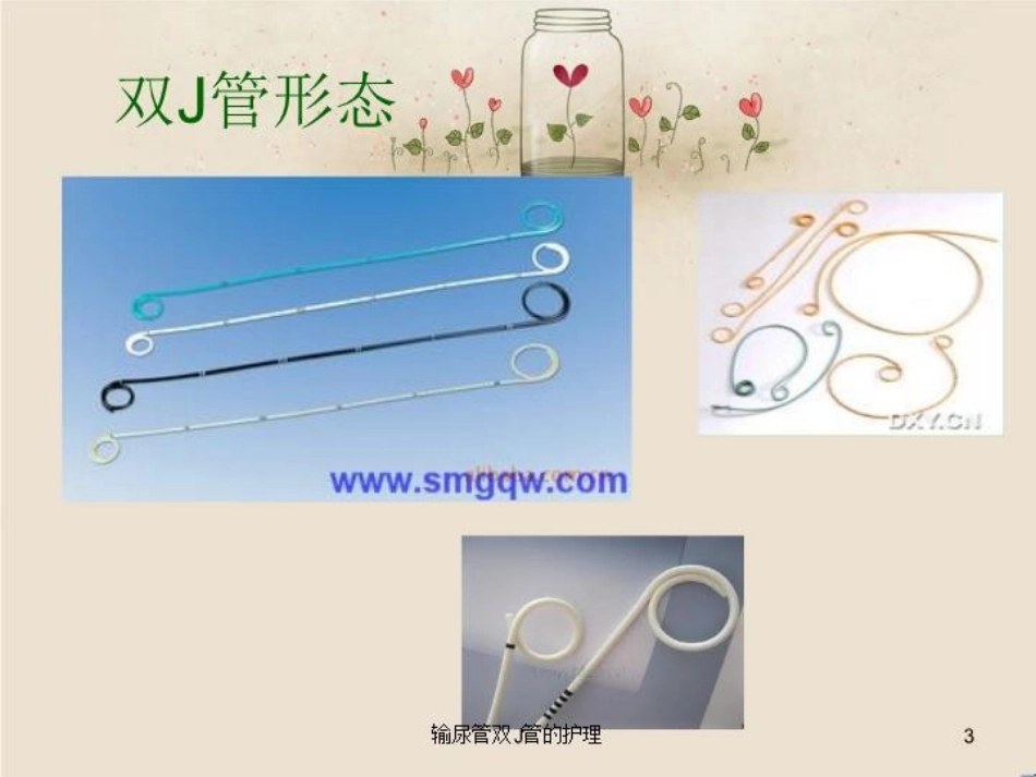 输尿管双J管的护理培训课件.pptx_第3页