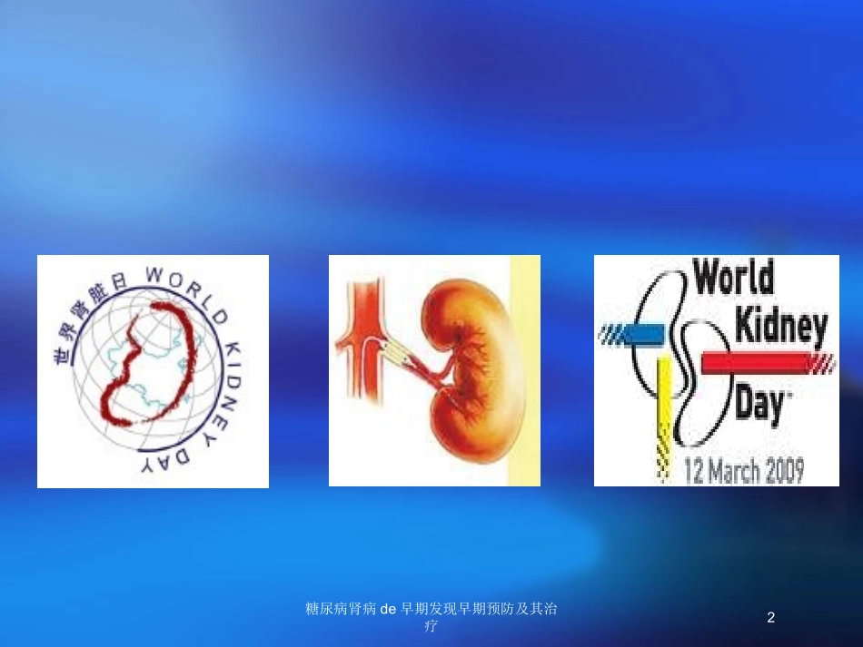 糖尿病肾病的早期发现早期预防及其治疗培训课件.pptx_第2页